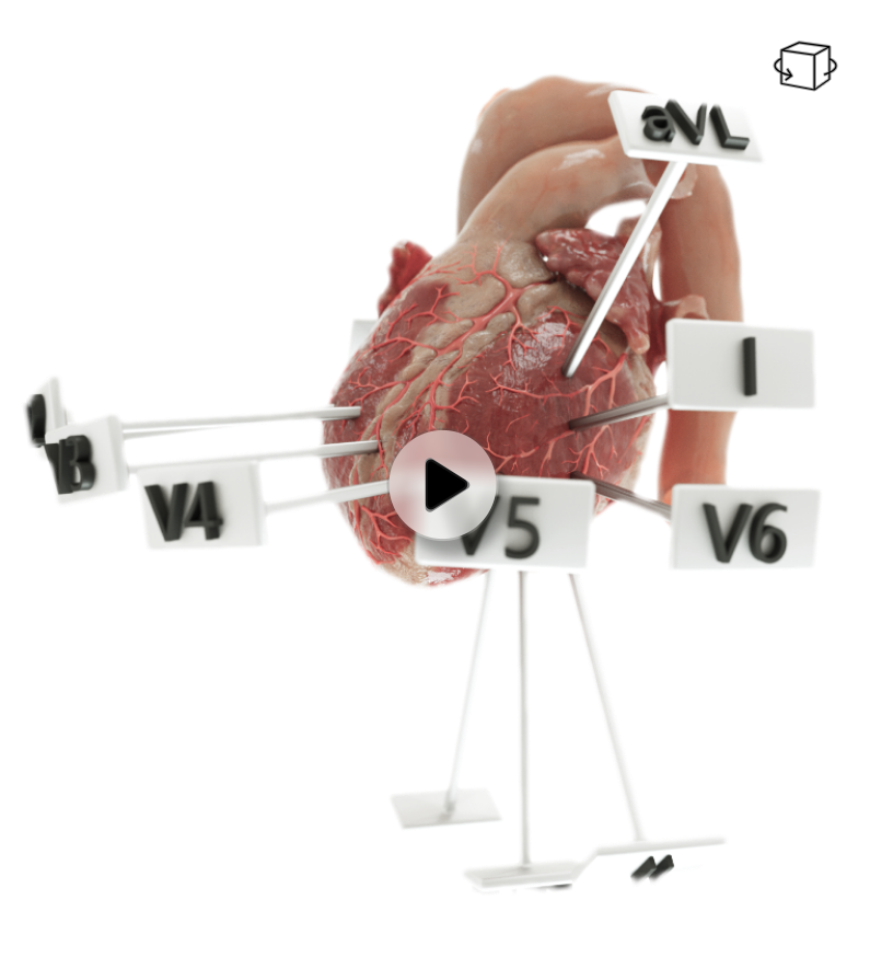 Ecg Lead Placement With 3d Illustrations